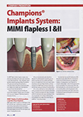Champions® Implant System: MIMI®-Flapless I & II